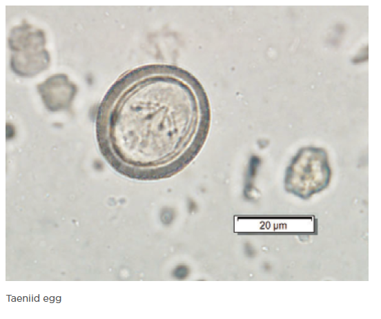 Echinococcus Granulosus Egg Echinococcus Granulosus Egg