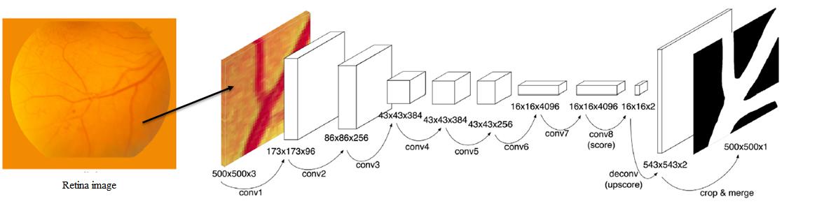 Retina image passing through a convolutional encoder-decoder network to produce a blood vessel map.